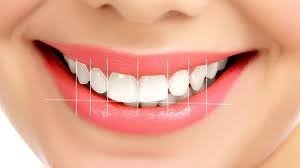 Hollywood Smile